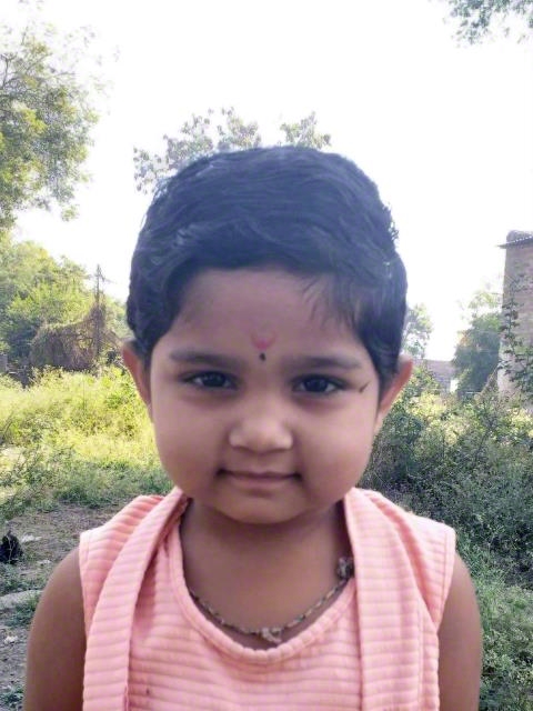 World Vision India